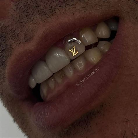 lv tooth gem|Tooth Gems LV.